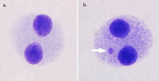 Análisis microscópico de células binucleadas